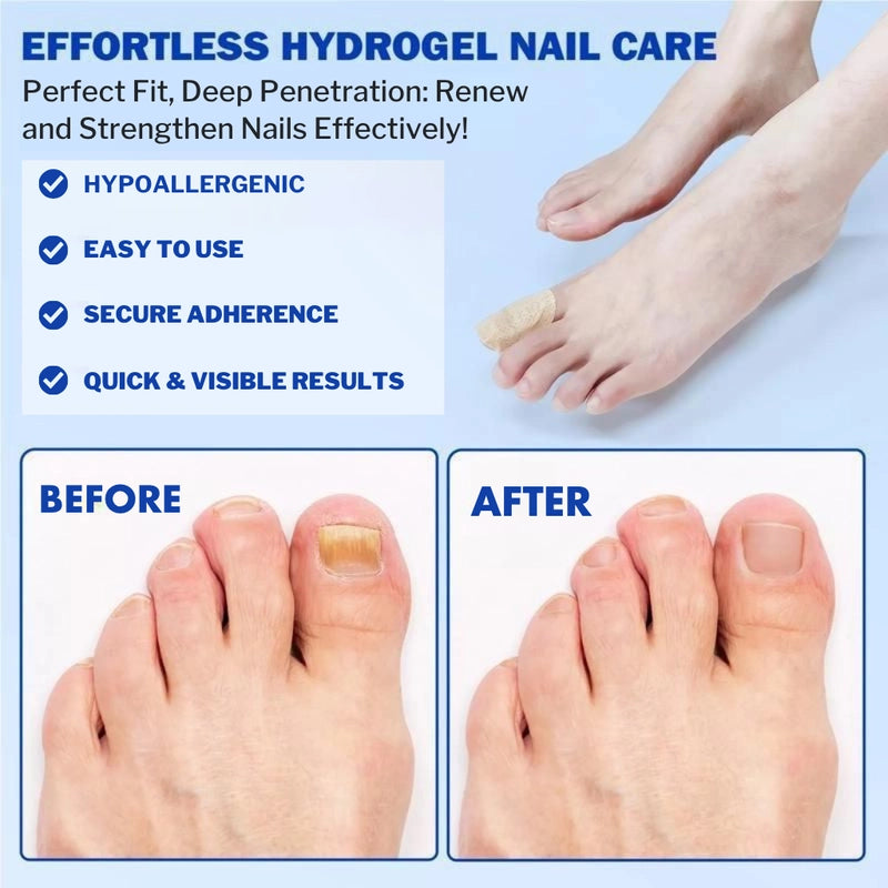 ClearNail&Co™ - Fungal BioPatch